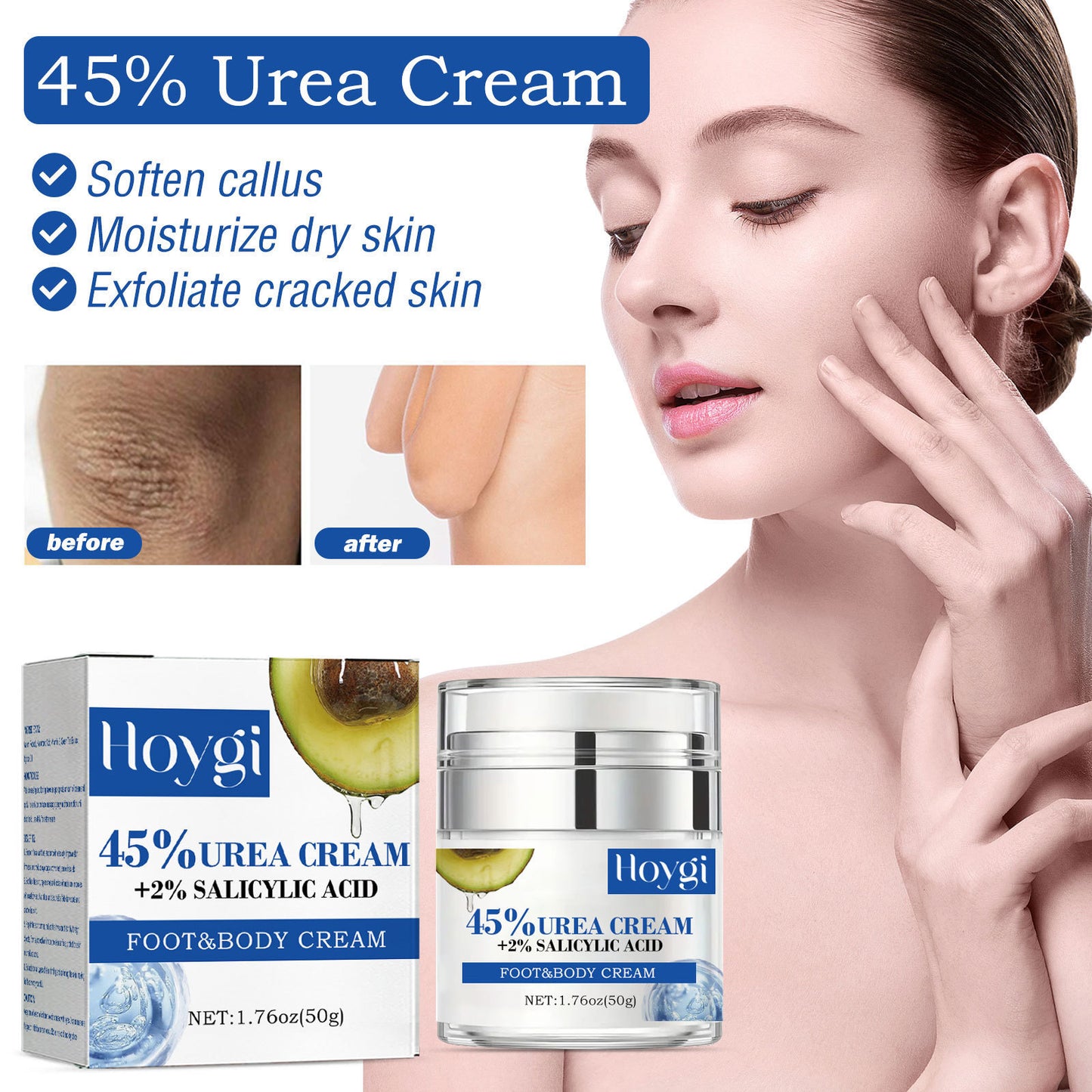 Hoygi - Skin Anti-freeze Chapped And Peeling Body Moisturizing