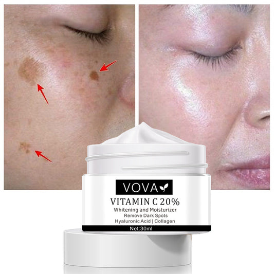 VOVA: Vitamin C 20 Percent Face Cream, Moisturizer, Dark Spot Remover 30ml